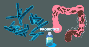 Probiotics for IBS Management