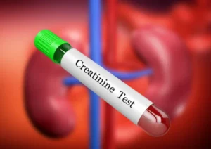 Is creatinine level 1.7 dangerous