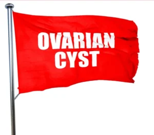 what size of ovarian cyst is dangerous?