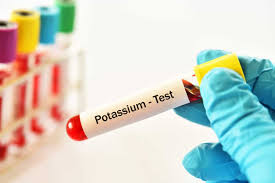 Is Low Potassium a Sign of Cancer